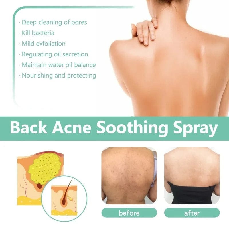 D-More Back Acne Spray – Easy, Effective, Acne-Free 🌿 - dmore