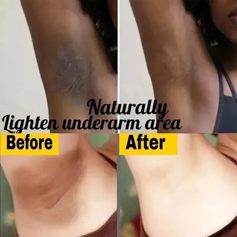 SD Inner Thigh Brightening Cream – Instant Glow, Instant Confidence! 🌿 - dmore