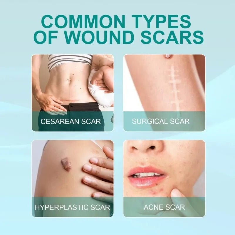 D-More Scar Removal Spray - Say Goodbye to Scars🌿 🌼