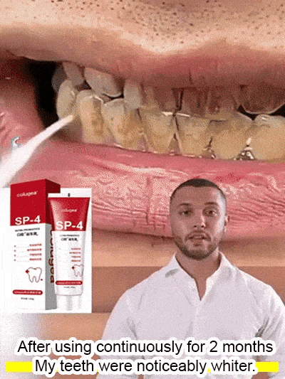 D-More Original Intensive Teeth Whitening Toothpaste-๐ฅBuy 1 Get 1 Free๐ฅ