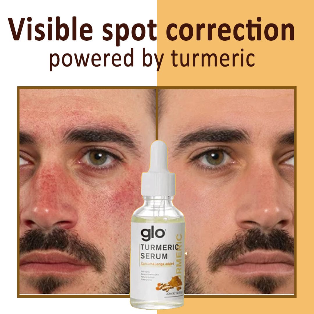 MD Turmeric Spot Corrector Serum – Buy 1 Get 1 FREE 🌿🔥Now @499🔥 - dmore