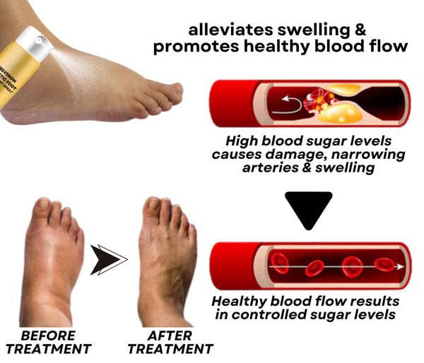 🌿 SC D-more BeeVenom Diabetic Foot Treatment Spray 🌟