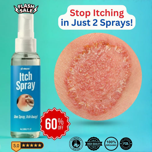SD Herbal Antifungal Itch Fix Spray - Instant Relief 🌿 - dmore