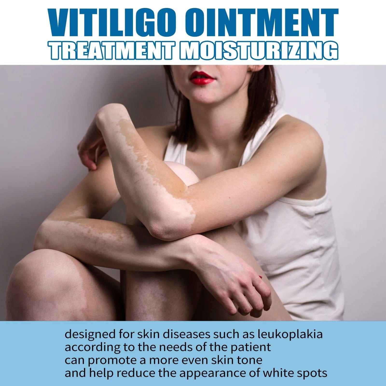 MD Herbal Vitiligo Cream- Visible Results in Just 7 Days! 🌸 PACK 2 - dmore