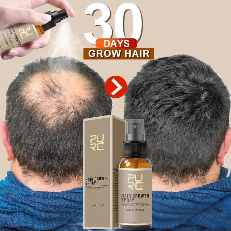 D-More Hair Growth Spray – Infused with Ginger & Angelica Extract 💧 - dmore