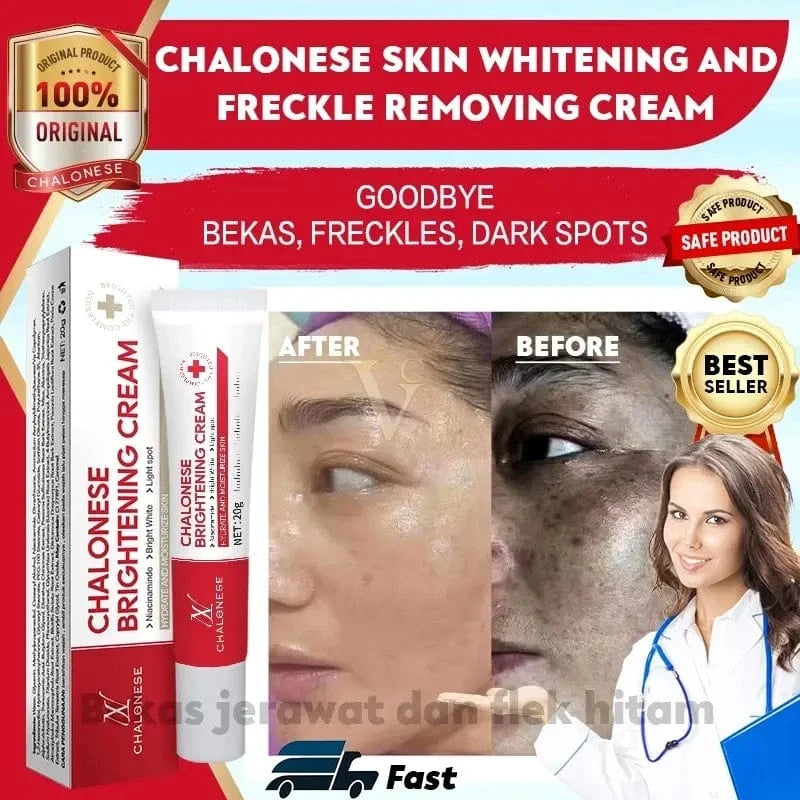 MD Chalonese Brightening Cream – Because Your Skin Deserves to Shine! 🌟 - dmore