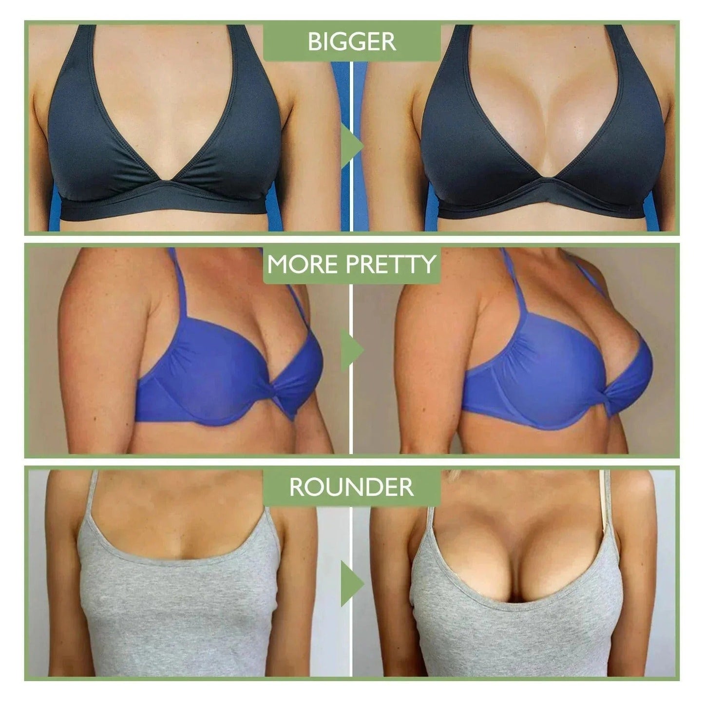 MD Breast Enlargement Cream – Bigger & Firmer in 2 Weeks 🔥 Buy 1 Get 1 Free 🔥 - dmore