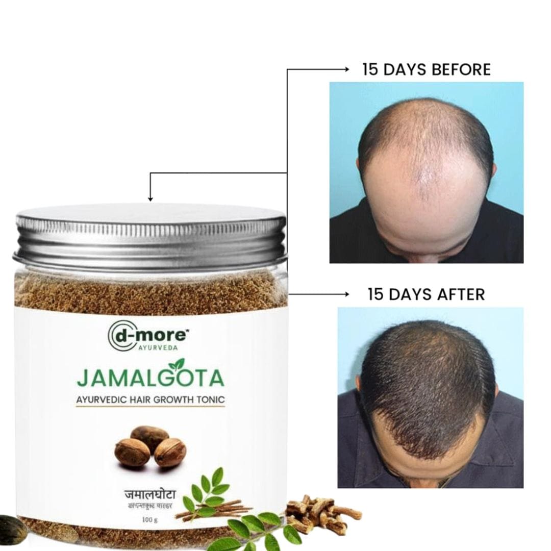 SD Jamalgota Ayurvedic Hair Growth Powder🌿 - dmore