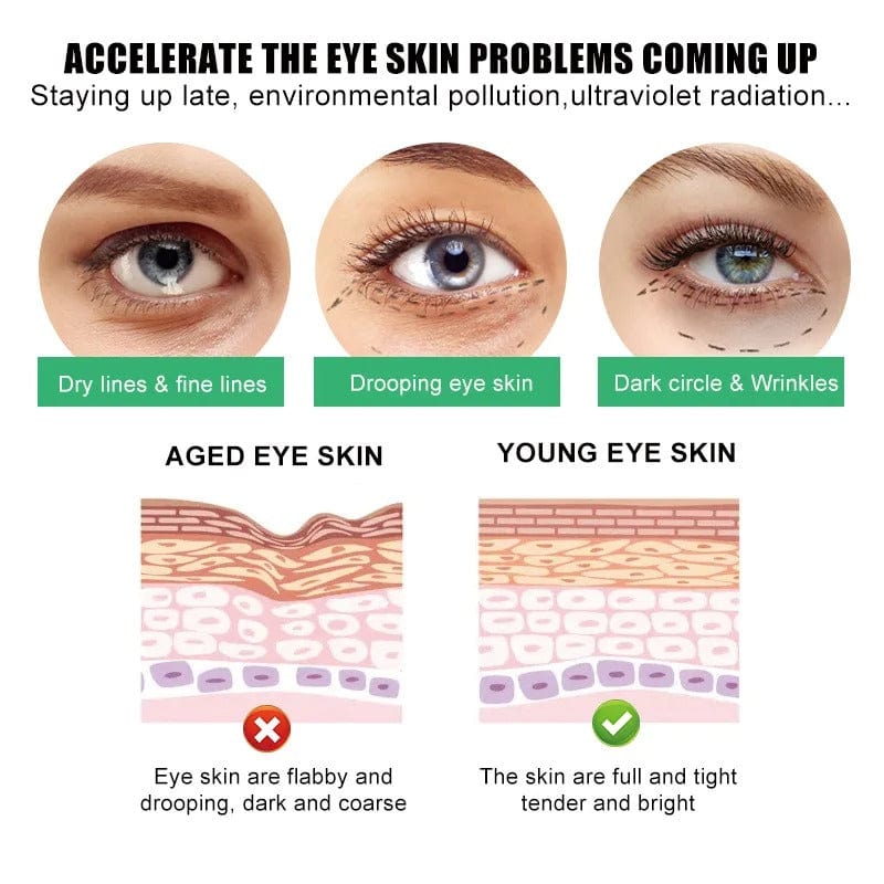 SD All-in-One Eye Cream - Say Goodbye to Puffiness & Wrinkles! ๐ Buy 1 Get 1 Free๐ - dmore