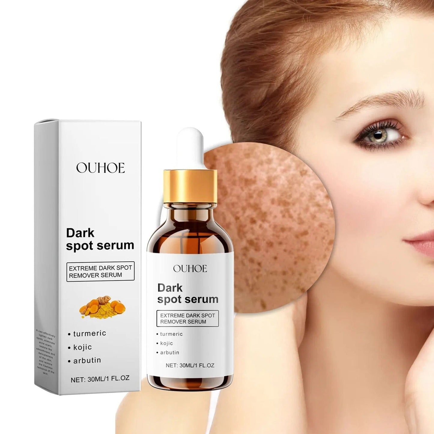 MD Turmeric Spot Corrector Serum - Fade Dark Spots in 2 Weeks 🌟💛 - dmore