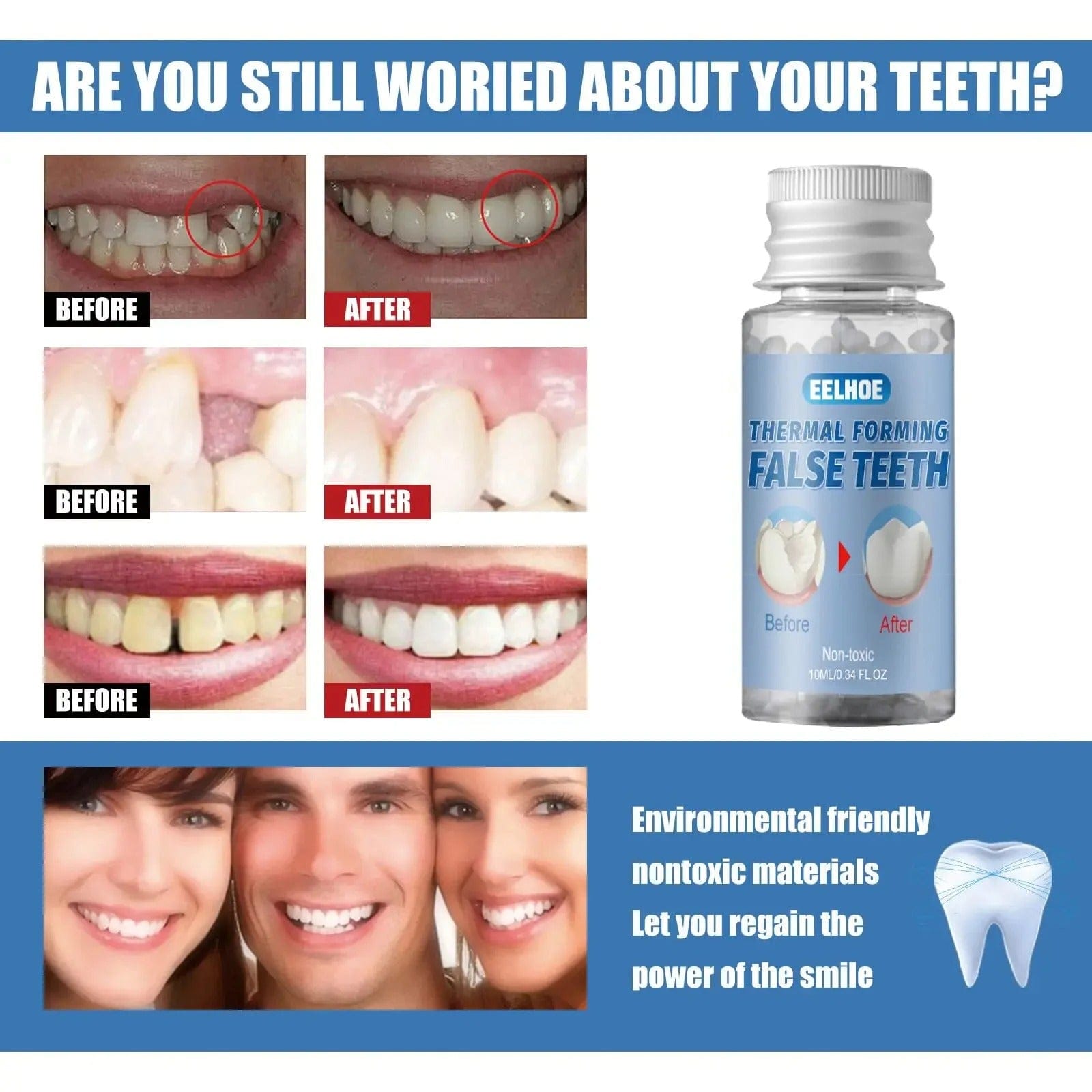 D-More Instant Tooth Repair Kit – Dentist-Inspired DIY Solution 🦷 🛠️ - dmore
