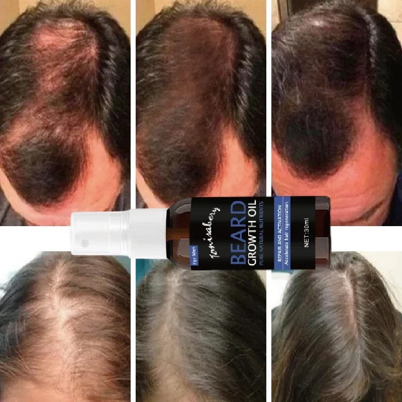 SC D-More Minoxidil 5% Beard & Hair Serum – Regrow, Strengthen & Shine!🔥 - dmore