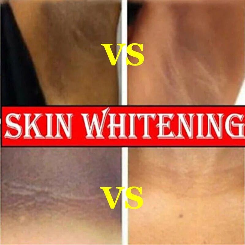 SD Ultimate Brightening Cream- Face, Body & Intimate Care🌸 - dmore