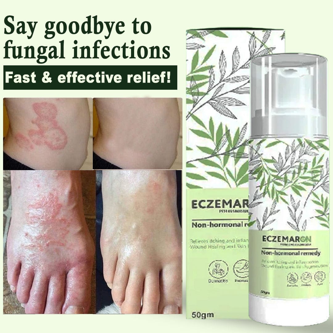 SC D-More Ecze+ Anti Fungal Spray - Doctor's Recommended 👨🏽⚕️ Buy 1 Get 1 Free - dmore