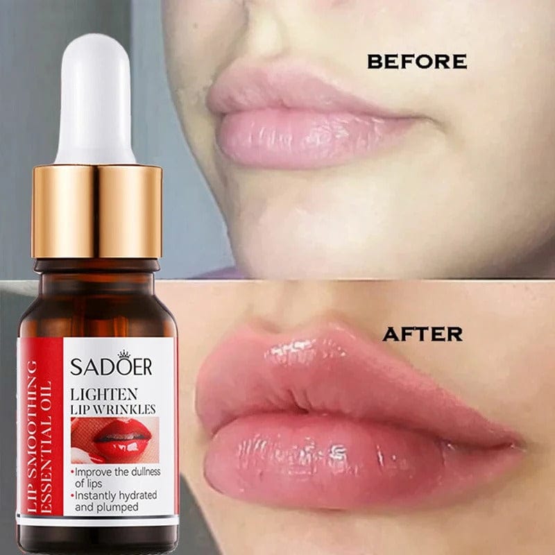 SD Hyaluronic Acid Lip Serum – Your Secret to Plumper Lips in 7 Days 💋 Buy 1 Get 1 Free🔥 - dmore