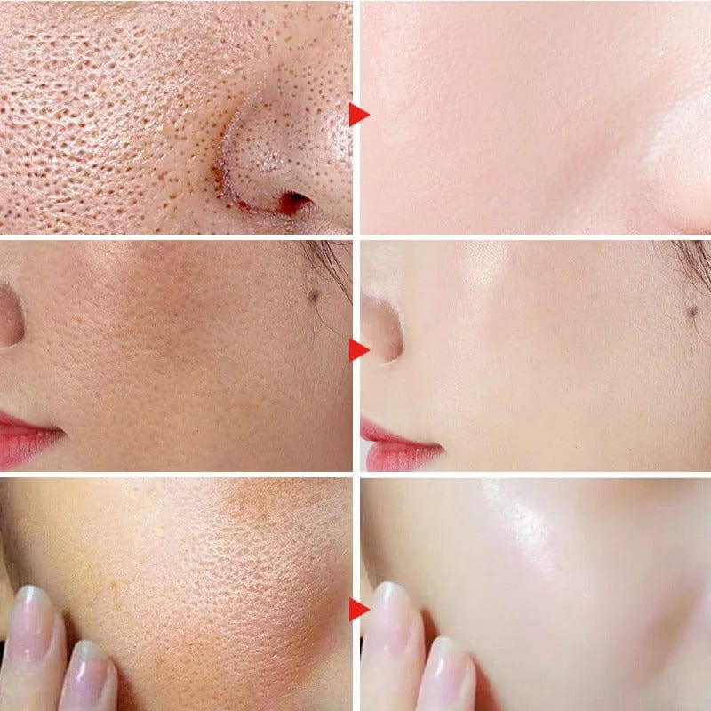 SC D-More Pore Perfecting Serum – Korean 🇰🇷 Secret Formula with 10% Lactic Acid 🌿 - dmore
