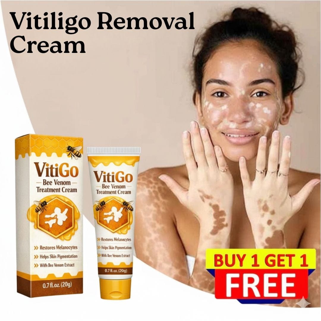 Vitigo™ Advanced Vitiligo Restore Cream ✨ | Buy 1 Get 1 Free 🔥 - dmore