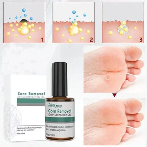 SD Corn Removal Serum š£ No More Pain, No More Corns - ⨠Buy 1 Get 1 Free ā” - dmore