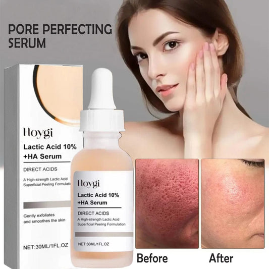 SC D-More Pore Perfecting Serum – Korean 🇰🇷 Secret Formula with 10% Lactic Acid 🌿 - dmore