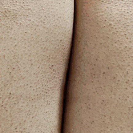 SD Strawberry skin removing cream - Buy 1 Get 1 Free 🔥