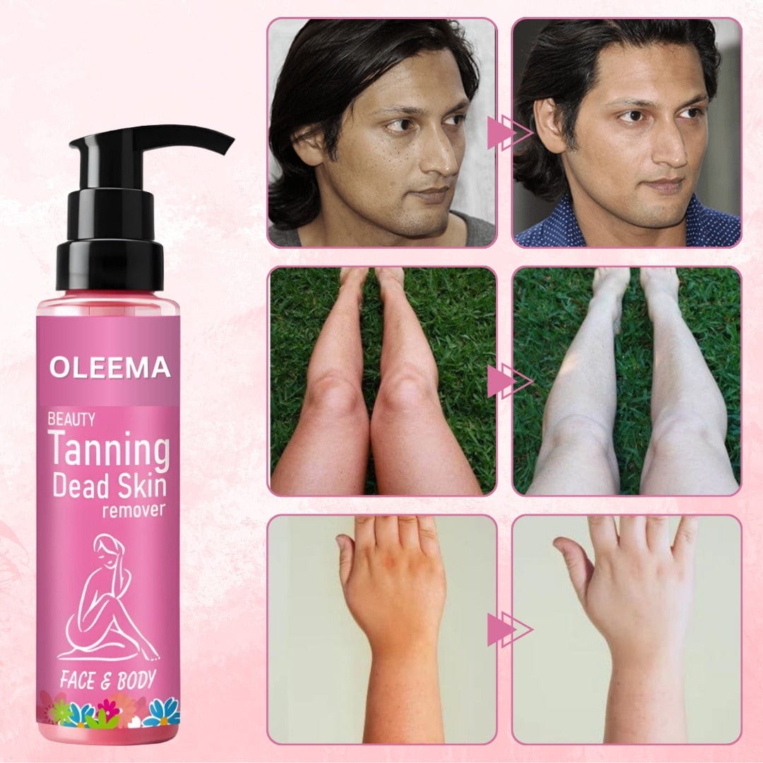 MD Oleema Beauty Tanning Dead Skin Remover-🔥Buy 1 Get 1 Free 🔥(100% Money Back) - dmore