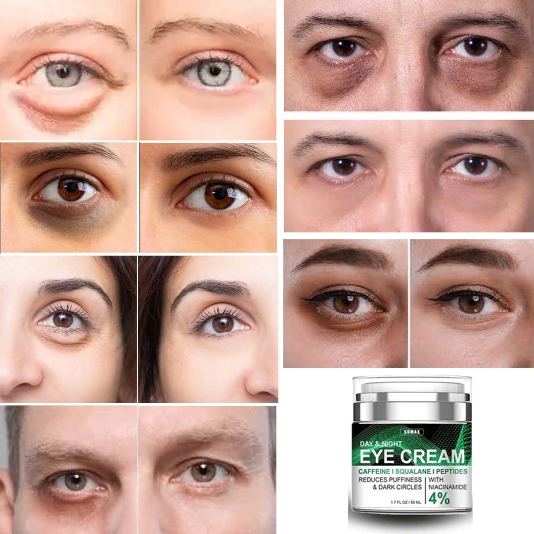 SD All-in-One Eye Cream - Say Goodbye to Puffiness & Wrinkles! ๐ Buy 1 Get 1 Free๐ - dmore