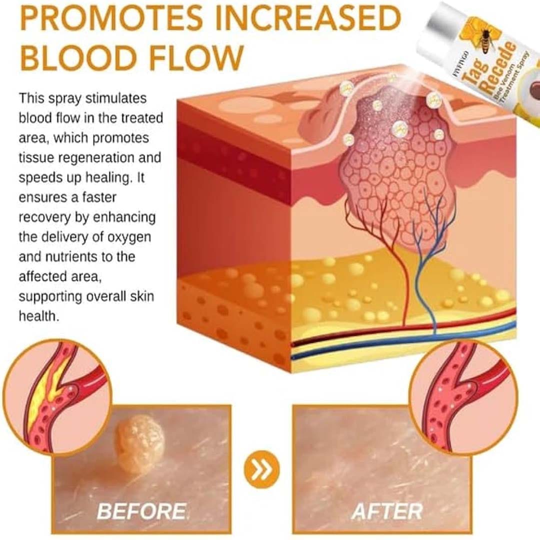 MD ✨ Instantly Remove Warts, Skin Tags & Moles – Painlessly & Safely! - dmore