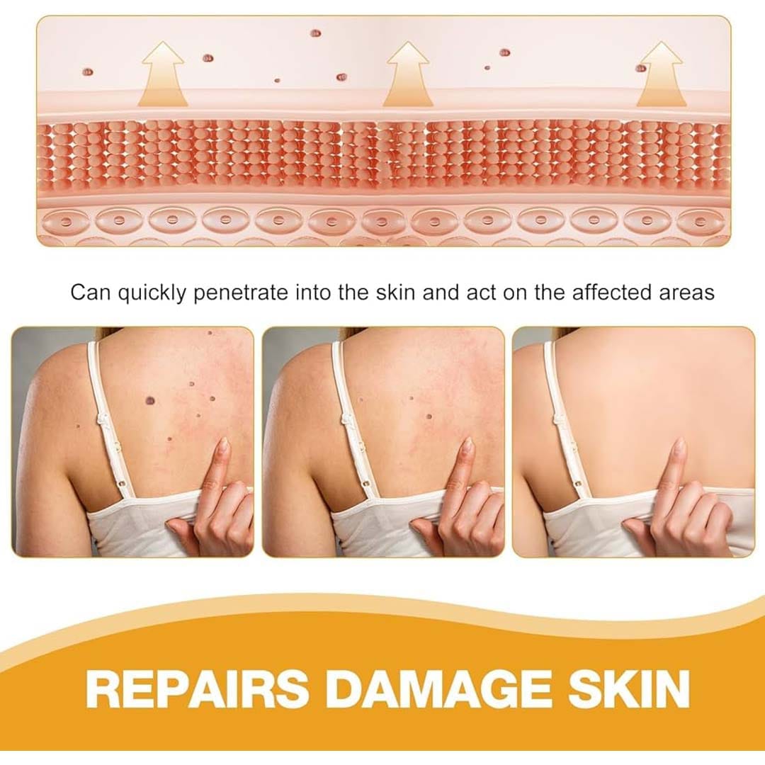 MD ✨ Instantly Remove Warts, Skin Tags & Moles – Painlessly & Safely! - dmore