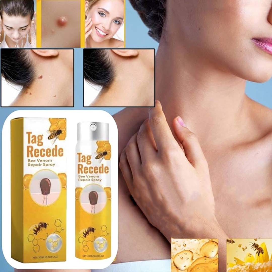 MD ✨ Instantly Remove Warts, Skin Tags & Moles – Painlessly & Safely! - dmore