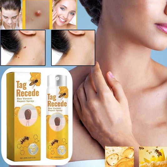 MD ✨ Instantly Remove Warts, Skin Tags & Moles – Painlessly & Safely! - dmore