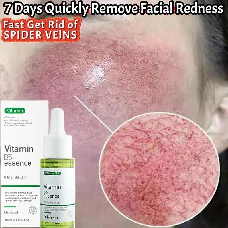 SC D-More Vitamin B5 Rosacea Repair Serum – Target Redness & Sensitivity✨ - dmore