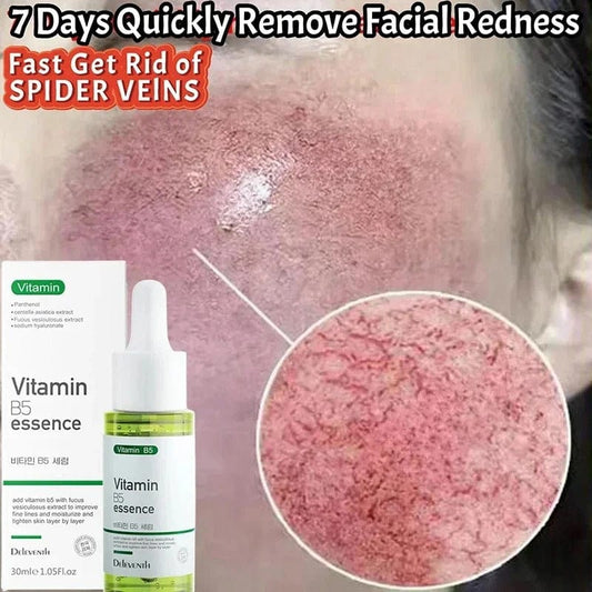 SC D-More Vitamin B5 Rosacea Repair Serum – Target Redness & Sensitivity✨ - dmore