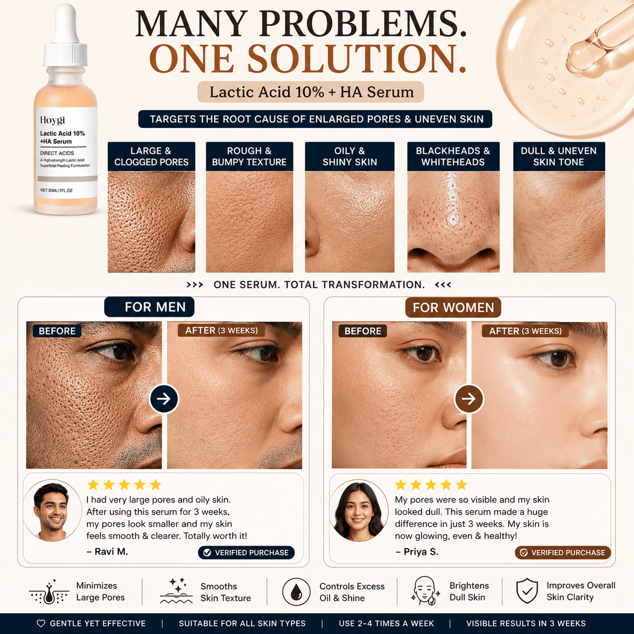SC Pore Perfecting Serum with 10% Lactic Acid
