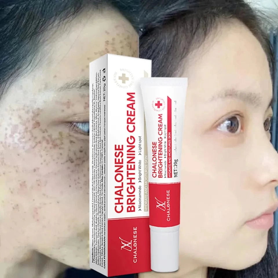 MD Chalonese Brightening Cream – Because Your Skin Deserves to Shine! 🌟 - dmore