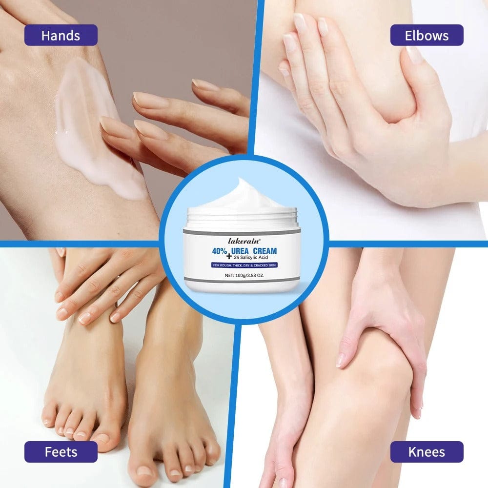 D-More All in One Hand & Feet Cream – Intense Hydration for Cracked Skin 💧 - dmore