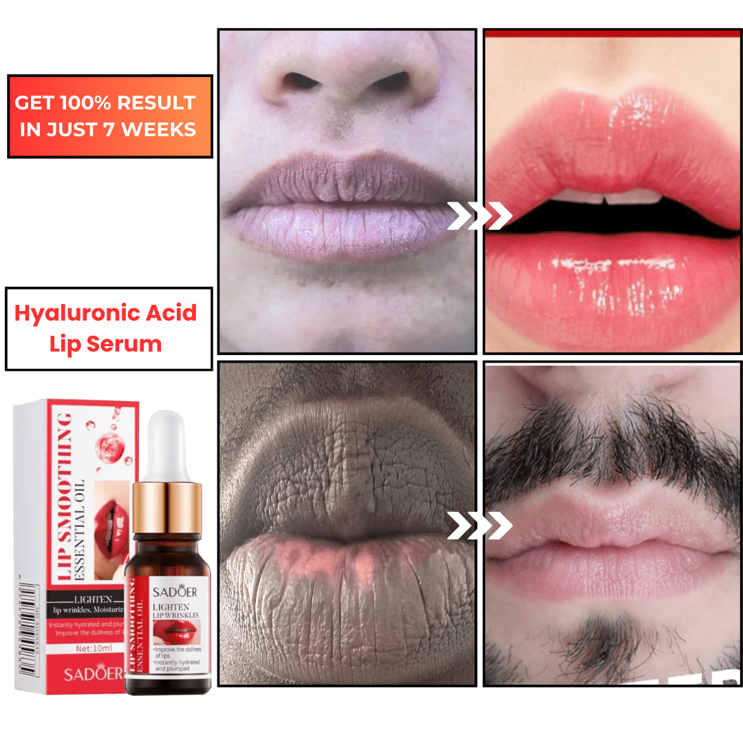 SD Hyaluronic Acid Lip Serum – Your Secret to Plumper Lips in 7 Days 💋 Buy 1 Get 1 Free🔥 - dmore