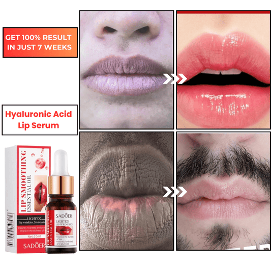SD Hyaluronic Acid Lip Serum – Your Secret to Plumper Lips in 7 Days 💋 Buy 1 Get 1 Free🔥 - dmore