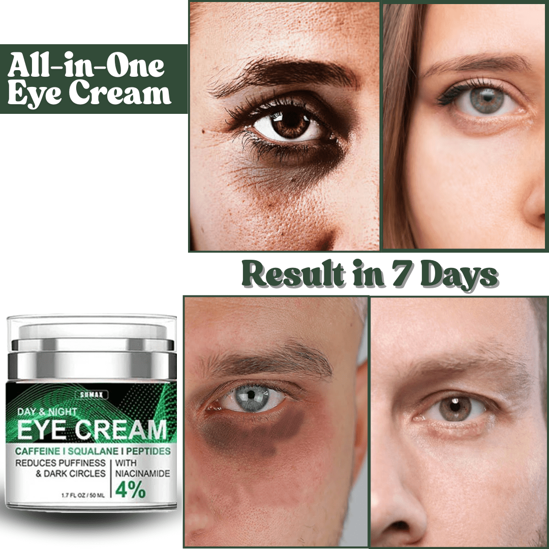 SD All-in-One Eye Cream - Say Goodbye to Puffiness & Wrinkles! 💖 Buy 1 Get 1 Free💖 - dmore