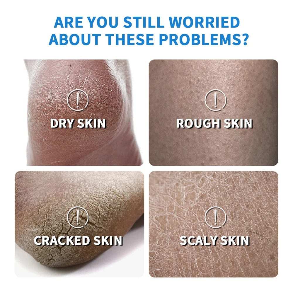 D-More All in One Hand & Feet Cream – Intense Hydration for Cracked Skin 💧 - dmore