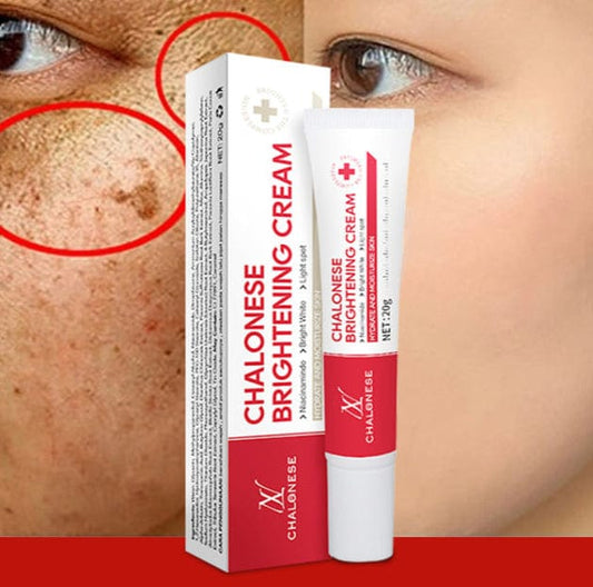 MD Chalonese Brightening Cream – Because Your Skin Deserves to Shine! 🌟 - dmore