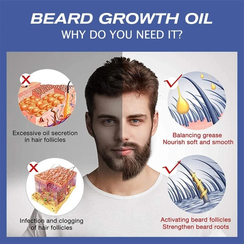 SC D-More Minoxidil 5% Beard & Hair Serum – Regrow, Strengthen & Shine!🔥 - dmore