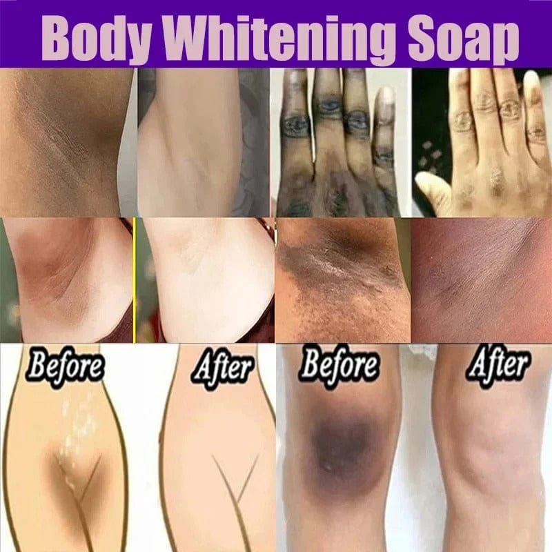 D-Tan Body Whitening Soap – Instant Tan Removal & Glow Booster 💖✨ Pack 2