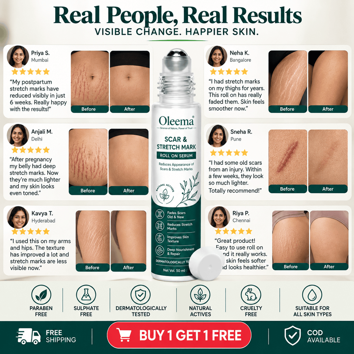 MD Oleema Scar & Stretch Mark Roll-On Serum