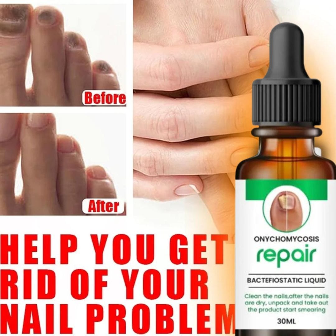 MD Professional All-in-One Nail Serum For Fungal Infection 🔥Buy 1 Get 2 Free🔥 - dmore