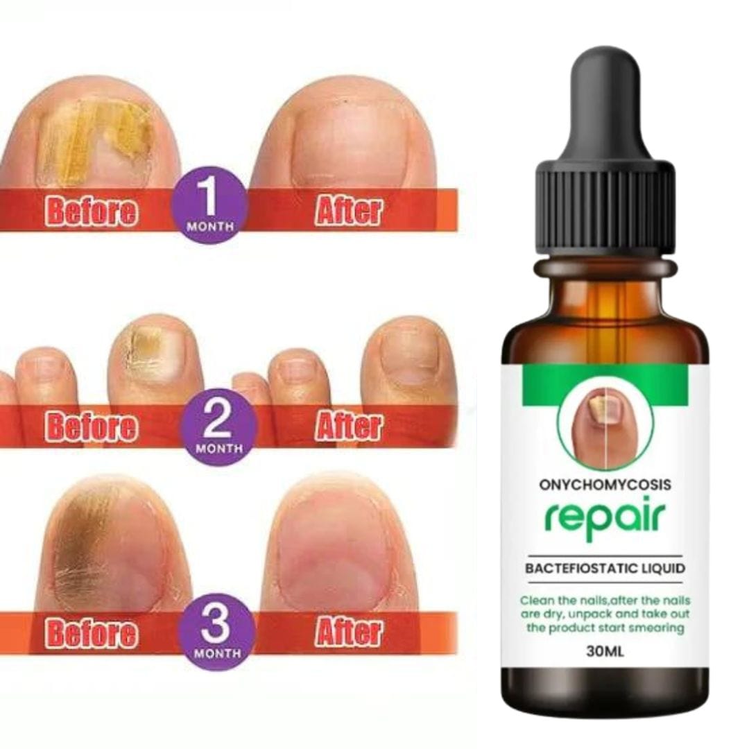 SC D-More All In One Nail Serum š„ All Doctors 1st Choice š„(Buy 1 Get 1 Free) - dmore
