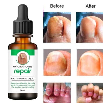 SC D-More All In One Nail Serum 🔥 All Doctors 1st Choice 🔥(Buy 1 Get 1 Free) - dmore