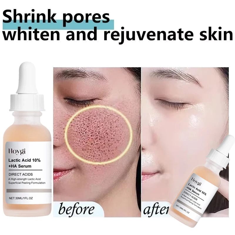 SC D-More Pore Perfecting Serum – Korean 🇰🇷 Secret Formula with 10% Lactic Acid 🌿 - dmore