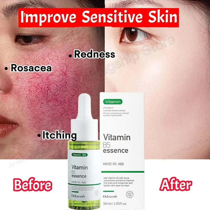 SC D-More Vitamin B5 Rosacea Repair Serum – Target Redness & Sensitivity✨ - dmore