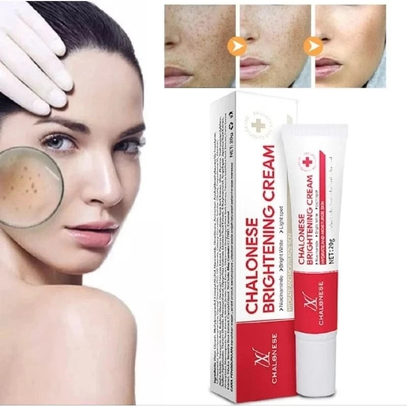 MD Chalonese Brightening Cream – Because Your Skin Deserves to Shine! 🌟 - dmore