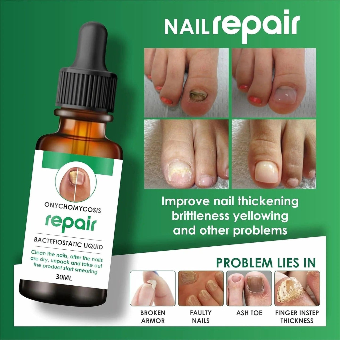 MD Professional All-in-One Nail Serum For Fungal Infection 🔥Buy 1 Get 2 Free🔥 - dmore